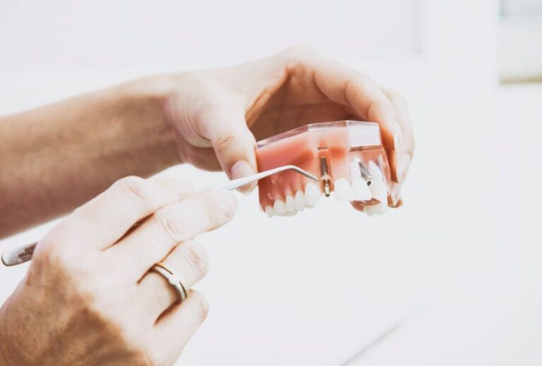 Read more about the article Dental Implants Procedure and Recovery