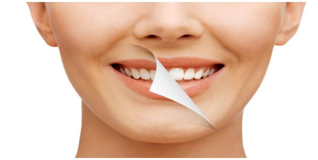 Read more about the article A Guide to Choosing The Right Teeth Whitening Shade