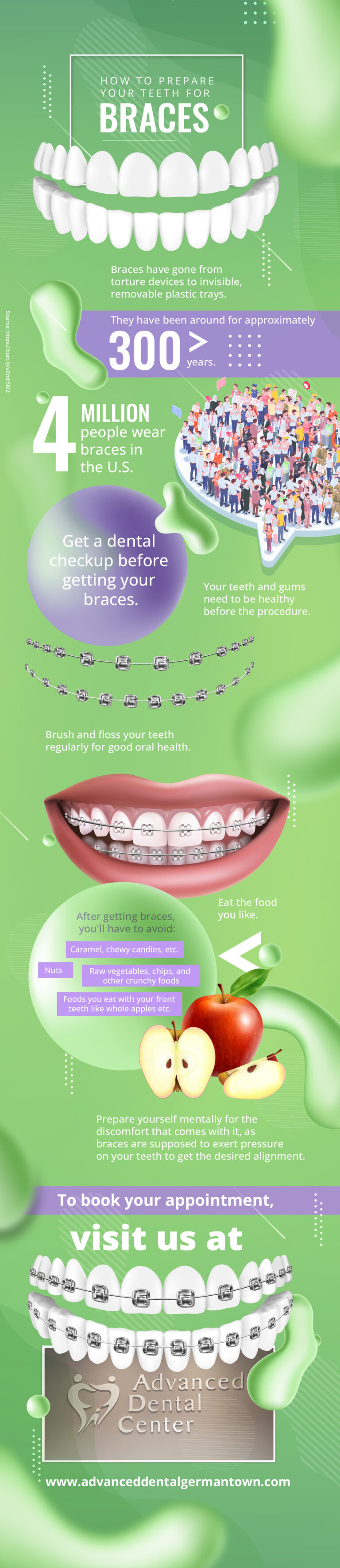 » Blog Archive How To Prepare Your Teeth For Braces Infographic