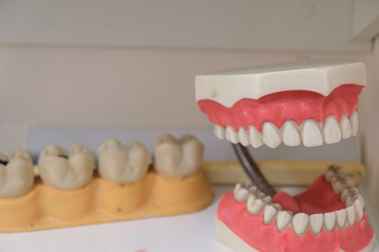 Read more about the article Types of Dentures You Should Know About