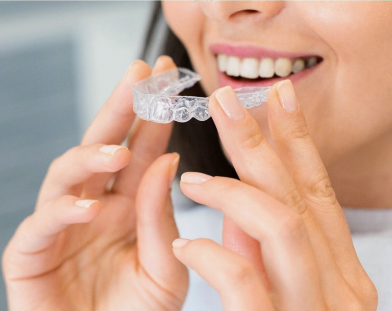 Read more about the article Why Should You Choose Invisalign Over Braces?