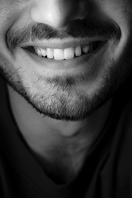 Read more about the article How Dental Bonding Can Improve Your Smile