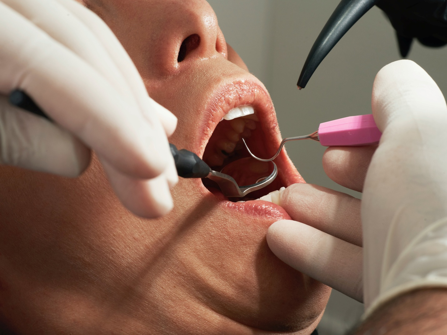 A dentist performing a dental check-up on a patient