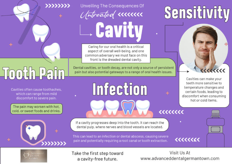 Read more about the article Unveiling the consequences of untreated Cavity – Infographic