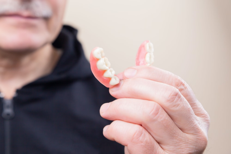 Read more about the article Dentures, Veneers, or Implants: Making the Right Choice for Your Smile