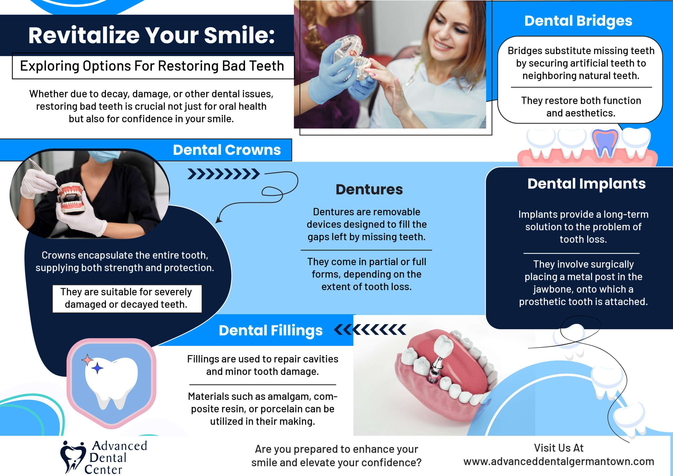 Read more about the article Revitalize Your Smile: Exploring Options For Restoring Bad Teeth – Infographic