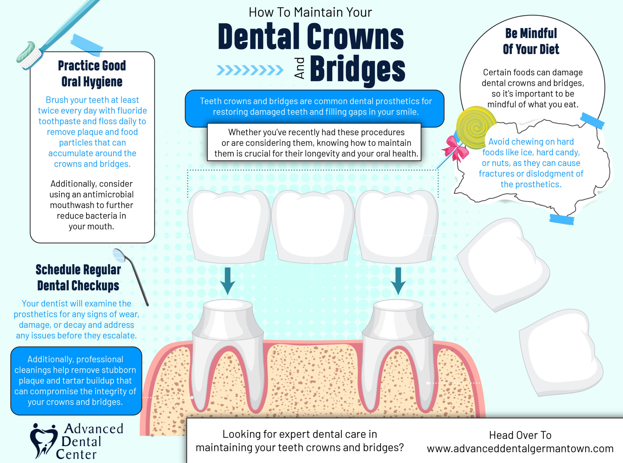 How to Maintain Your Dental Crowns and Bridges Infographic Advanced Dental Germantown