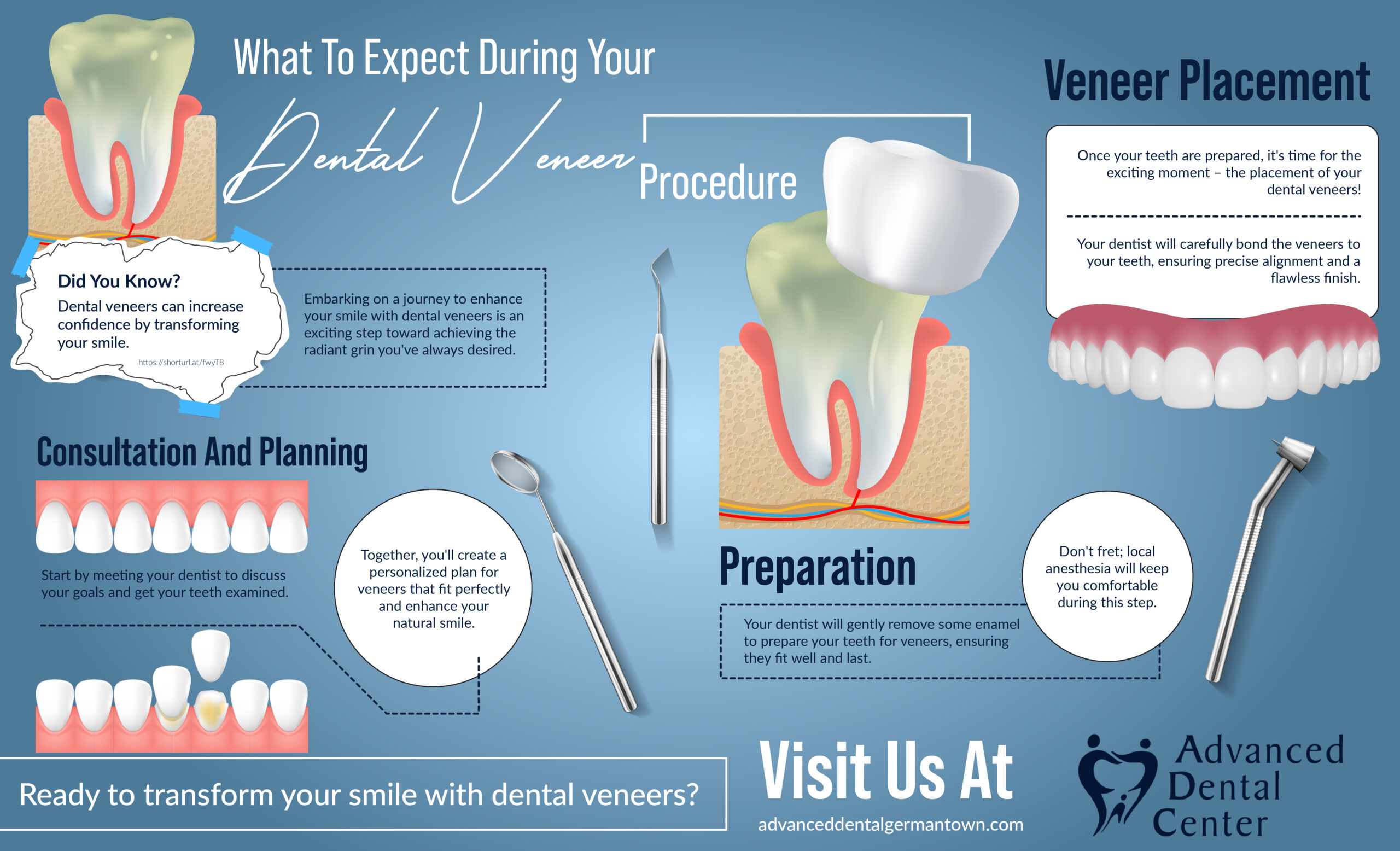 Read more about the article What to Expect During Your Dental Veneer Procedure – Infographic