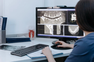 Dentist reviewing digital dental X-rays on a computer screen in a dental office