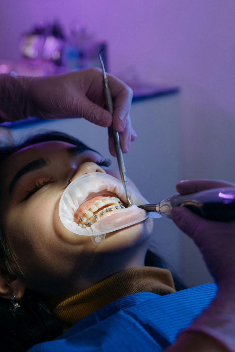 Read more about the article Root Canals: Debunking Myths and Understanding the Procedure