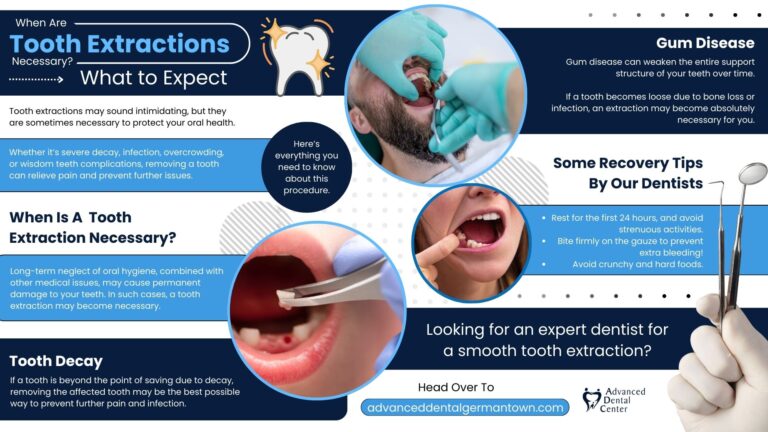 Read more about the article When Are Tooth Extractions Necessary? What to Expect?