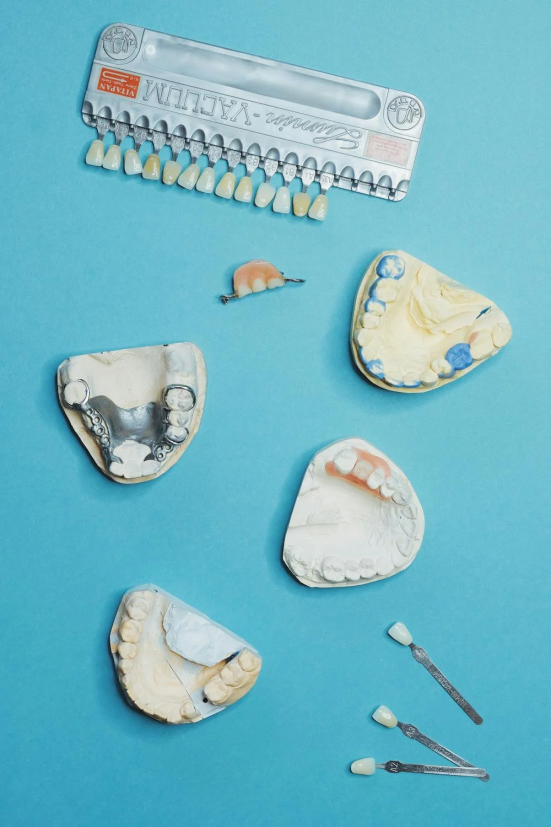 Read more about the article Why You Should Consider Dental Implants Over Dentures