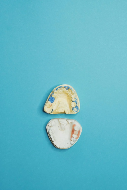 Two dental molds, one for the upper teeth and one for the