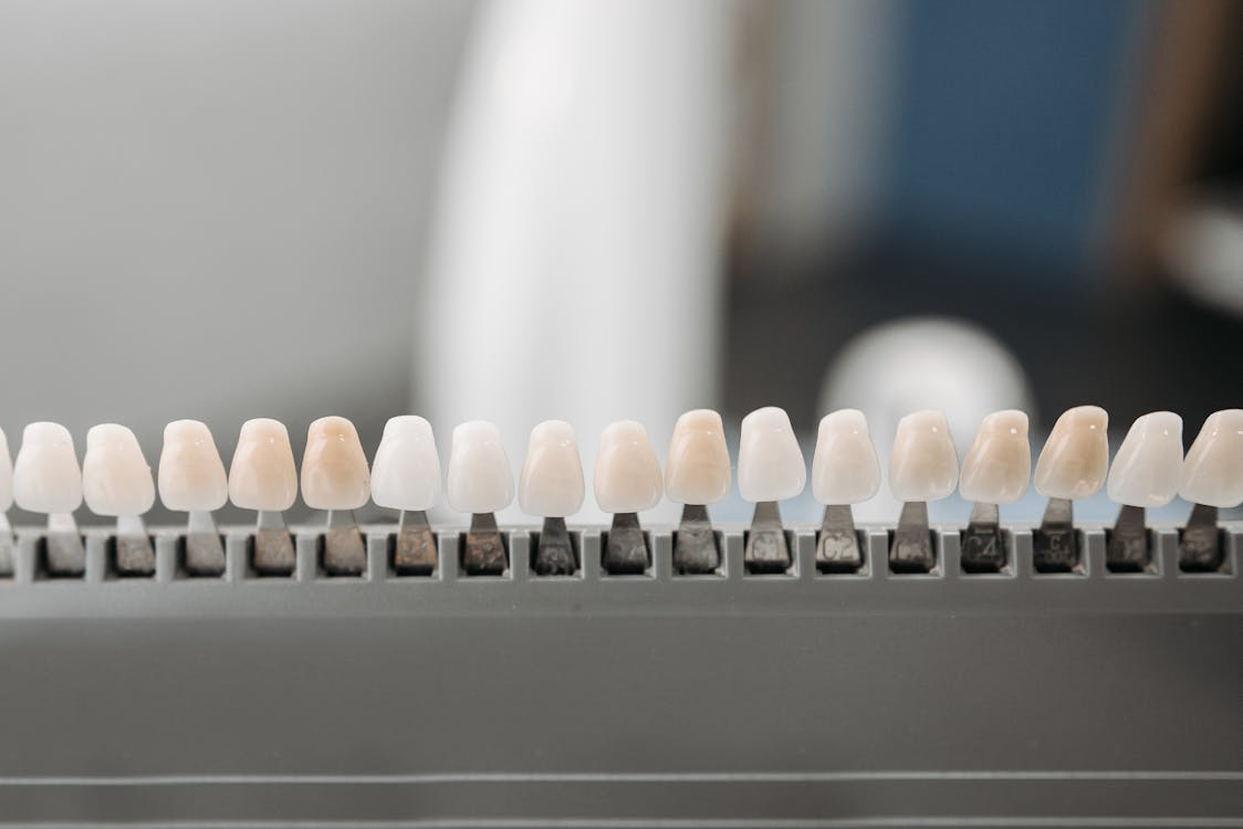Read more about the article Cosmetic Veneers vs. Crowns: What’s Right for Your Smile?