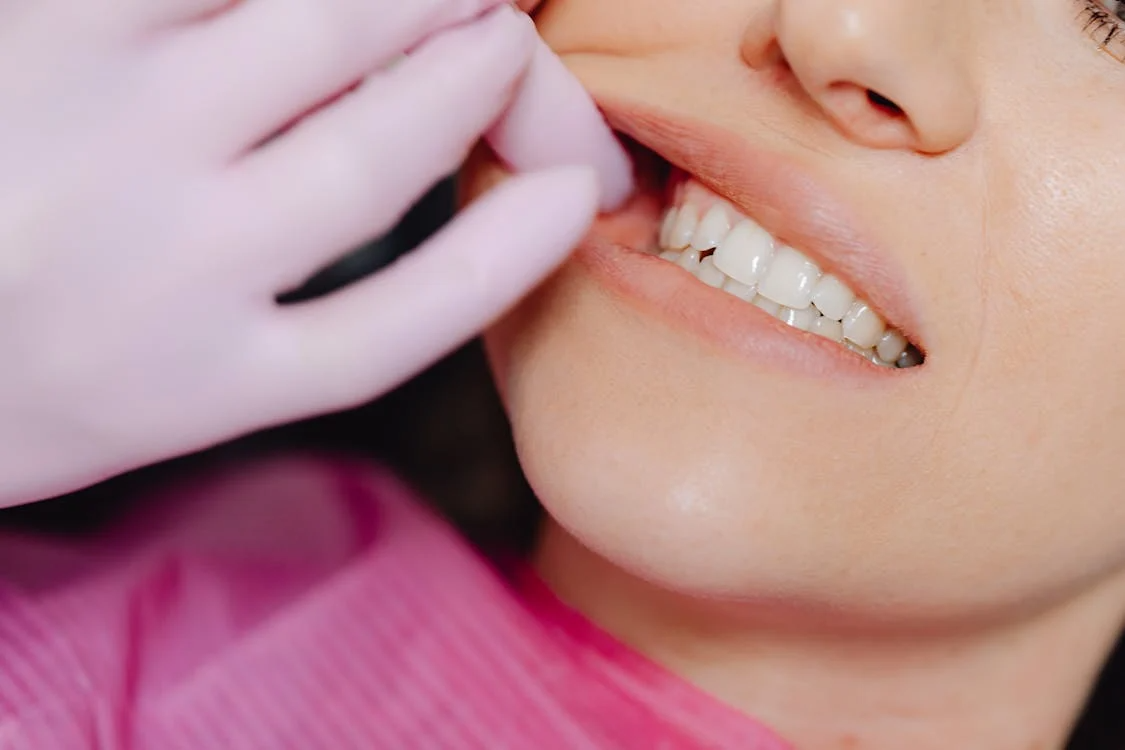 Read more about the article Understanding Gum Disease: Causes, Symptoms, and Treatment Options