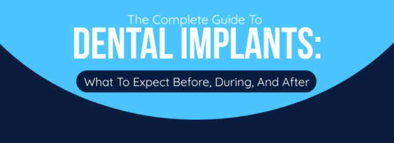 Read more about the article The Complete Guide to Dental Implants: What to Expect Before, During, and After