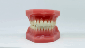 A dental model showing a full set of human teeth and gums is displayed on a white surface