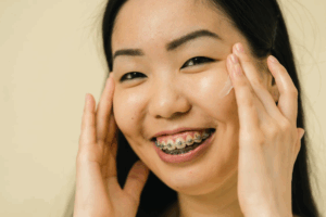 A smiling woman with braces is applying skincare cream to her face using both hands.