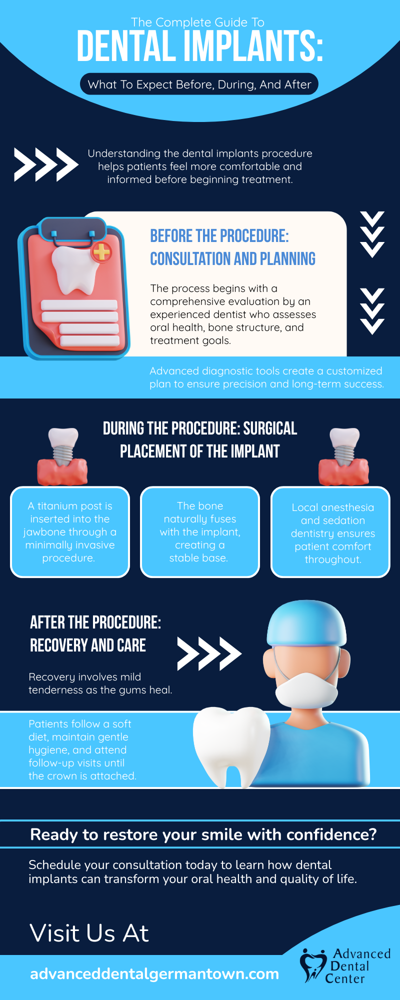 The Complete Guide to Dental Implants: What to Expect Before, During, and After