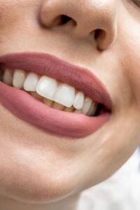 Close-up of a healthy smile