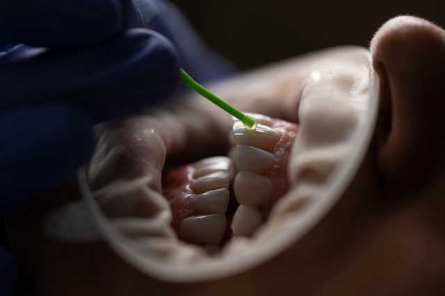 Close-up of dental procedure