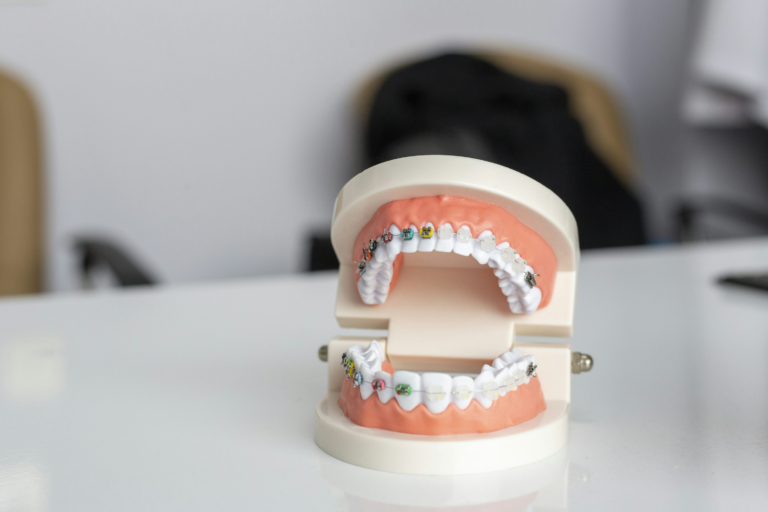 Read more about the article How Often Should You Take Your Children to the Dentist?