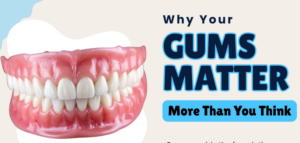 Why Your Gums Matter More Than You Think