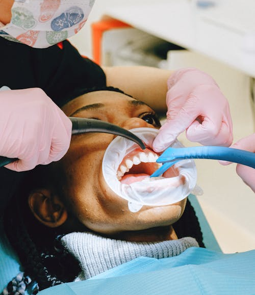 Read more about the article Why Your Gums Matter More Than You Think