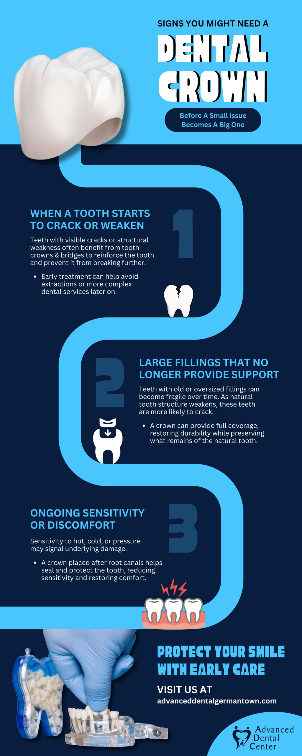 Signs You Might Need a Dental Crown — Before a Small Issue Becomes a Big One