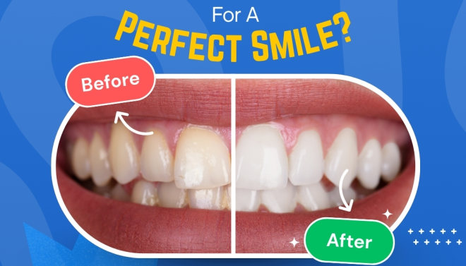 Read more about the article Smile Makeovers: What Options Are Available For A Perfect Smile?