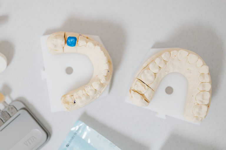 Read more about the article A Complete Guide to Dental Crowns and Bridges