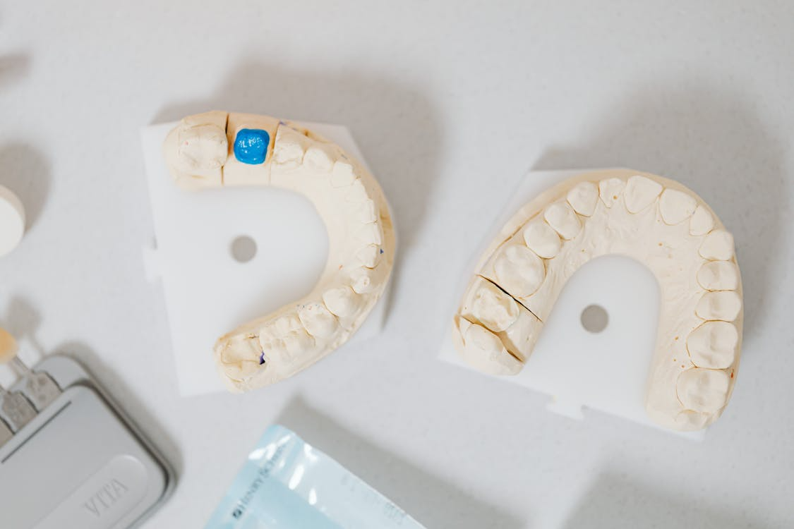 A Complete Guide to Dental Crowns and Bridges - Advanced Dental Germantown
