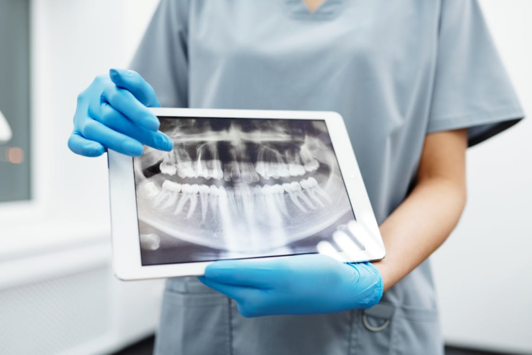 Read more about the article Signs You Might Need a Root Canal (And Why It’s Not as Scary as You Think)