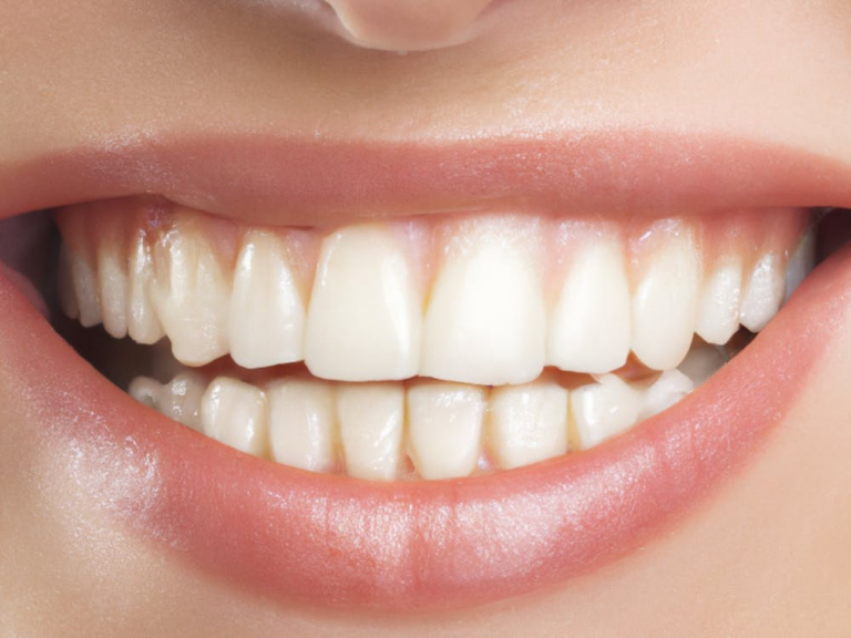 Read more about the article Cosmetic Dentistry: How to Achieve the Perfect Smile in 2026