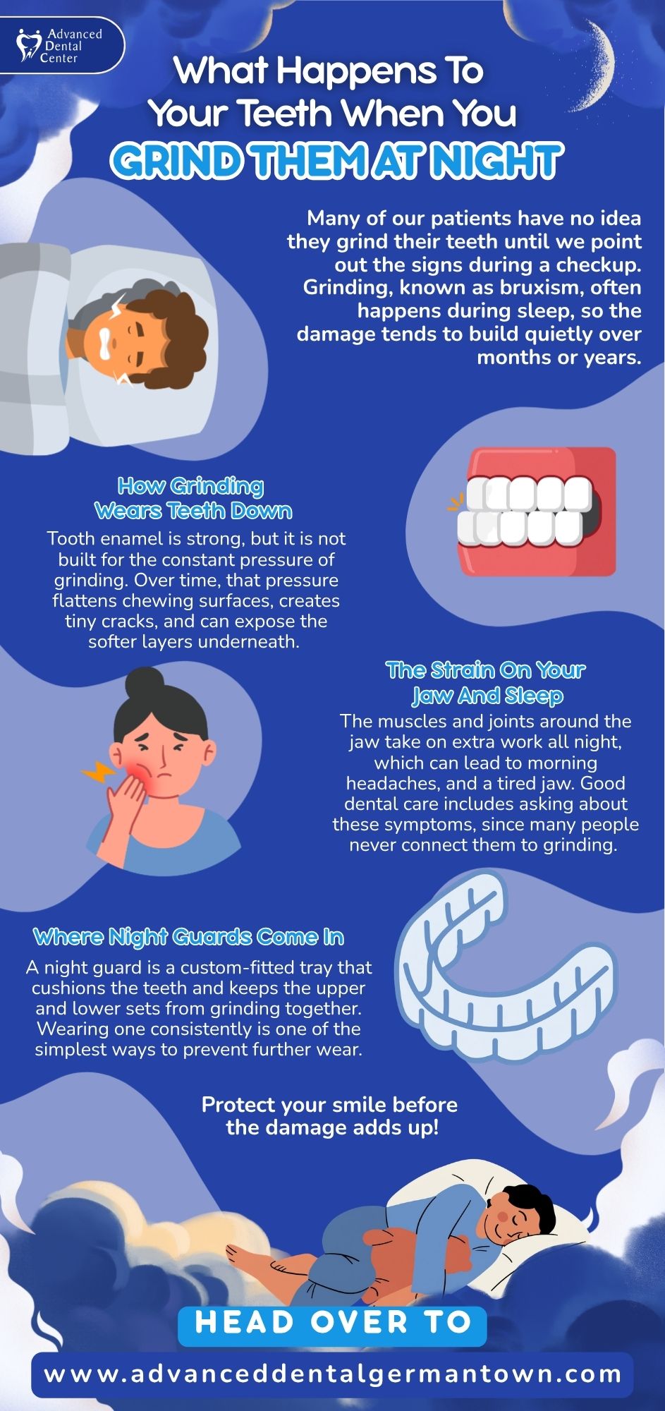 What Happens To Your Teeth When You Grind Them At Night