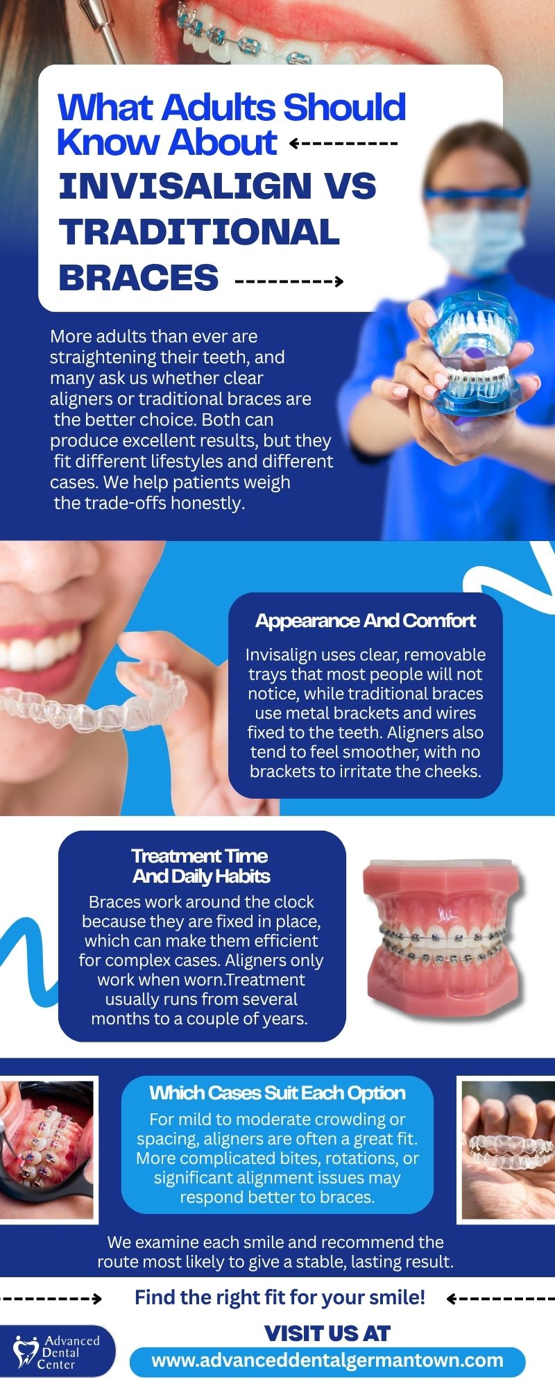 What Adults Should Know About Invisalign vs Traditional Braces