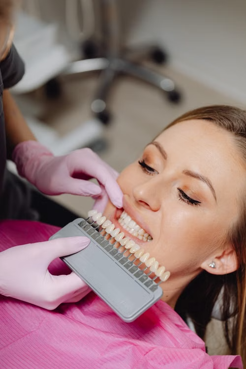 a shade guide held against a woman's smile