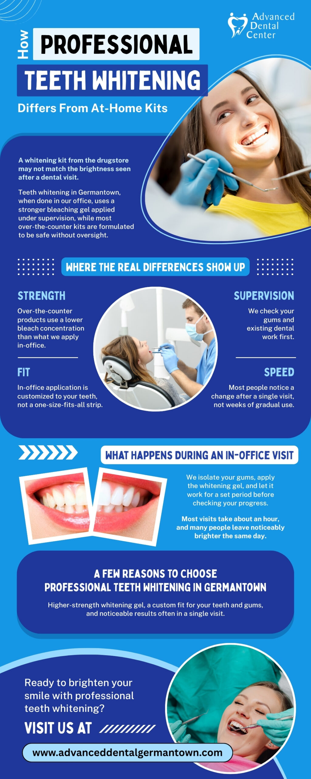 How Professional Teeth Whitening Differs From At-Home Kits