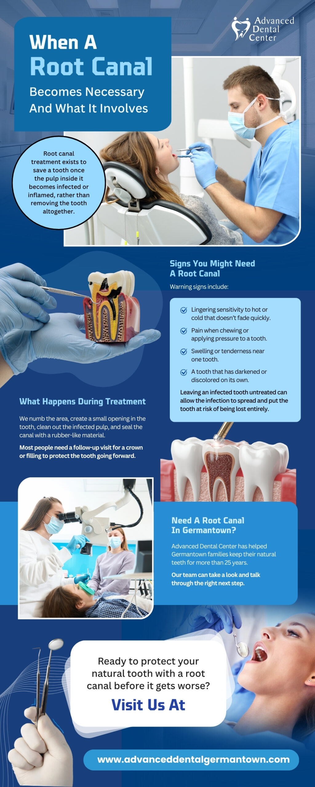 When A Root Canal Becomes Necessary And What It Involves