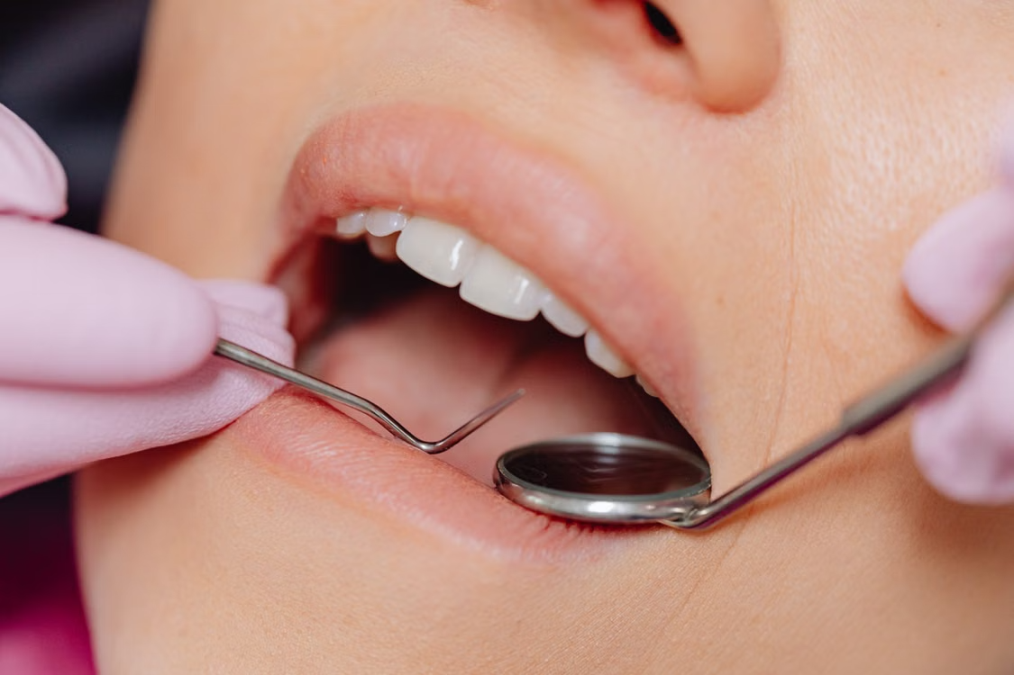 Read more about the article When Should You Consider Tooth Extraction?