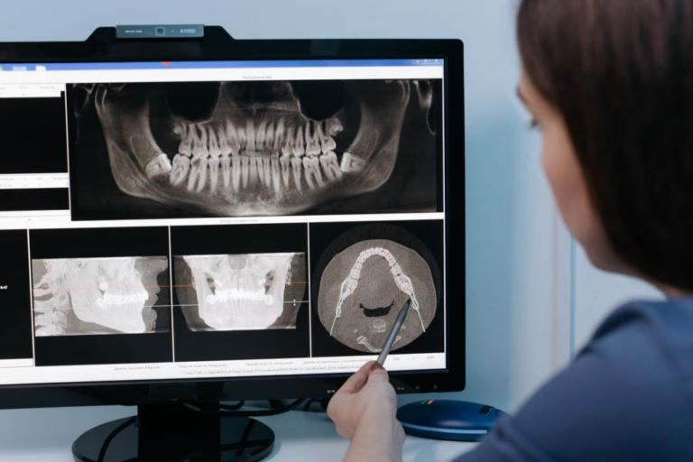 Read more about the article How Cone Beam CT Scans Help Dentists Plan Complex Dental Treatments