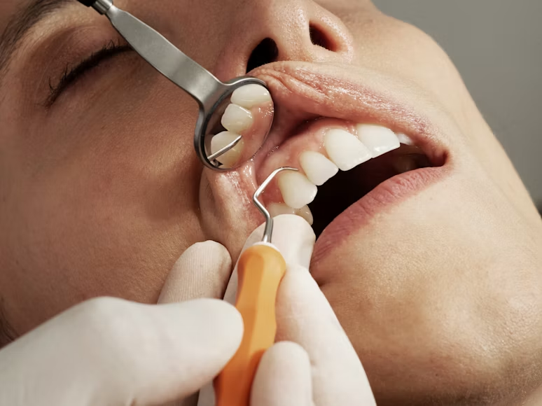 Read more about the article How Tooth Erosion Happens and Ways to Protect Your Enamel