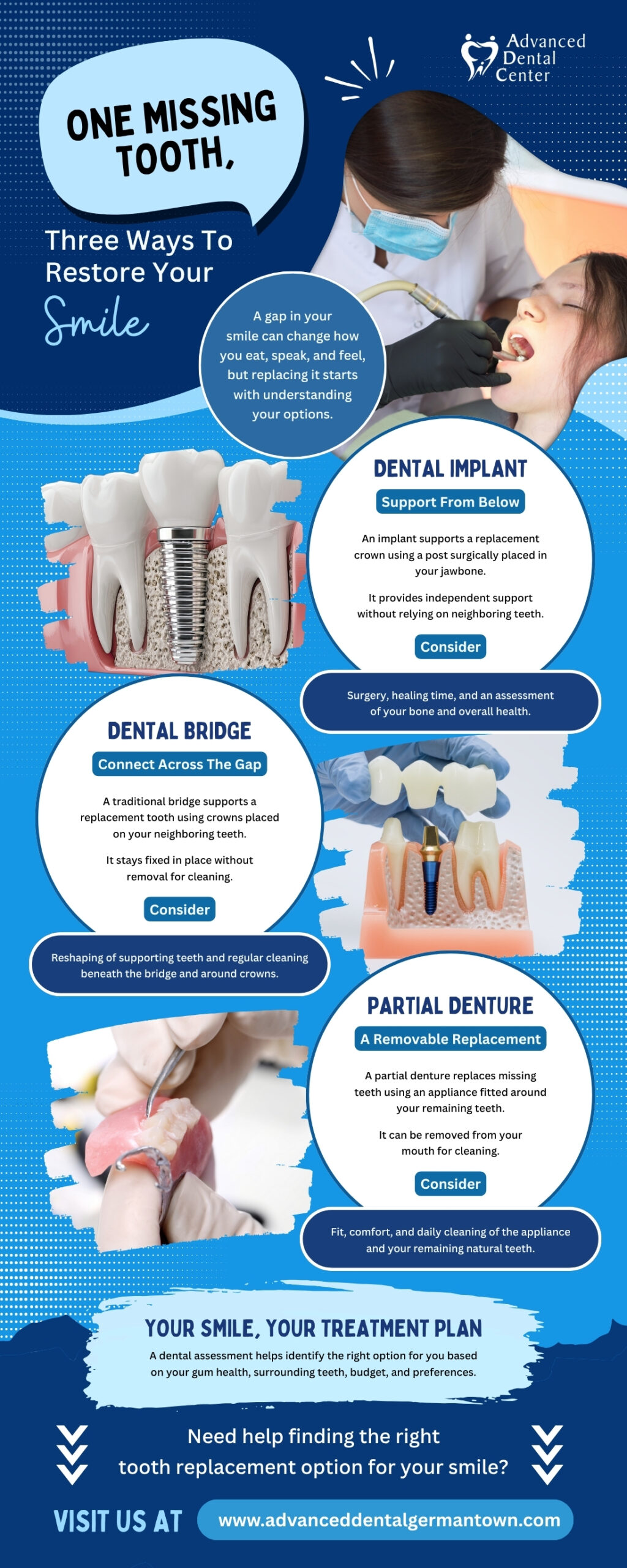 One Missing Tooth, Three Ways To Restore Your Smile